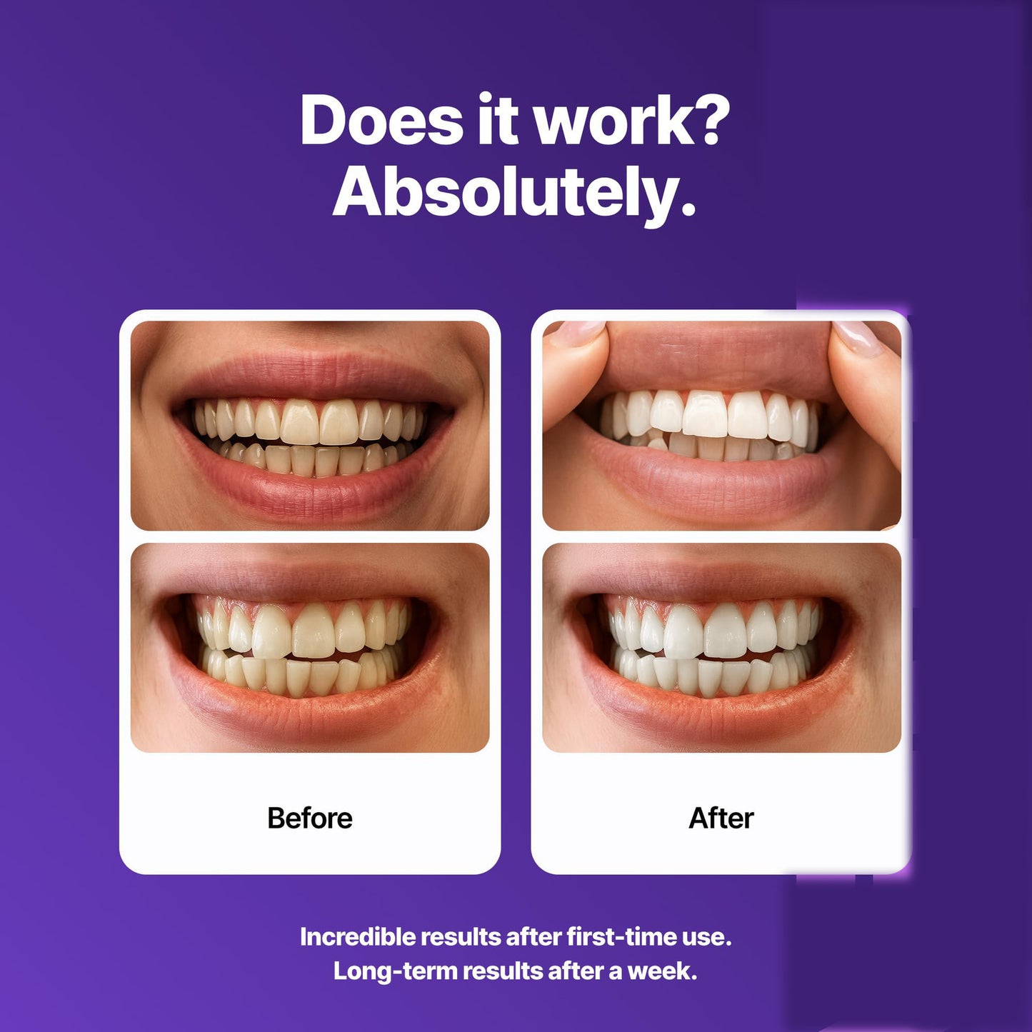 BrightSmile Strips