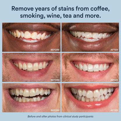 BrightSmile Strips